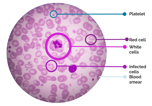 object-detection-blood-smear