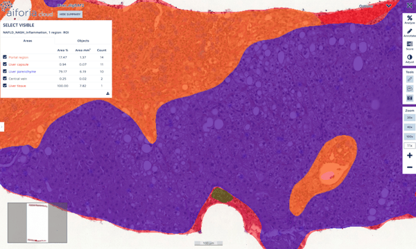 semantic-segmentation-aiforia-create