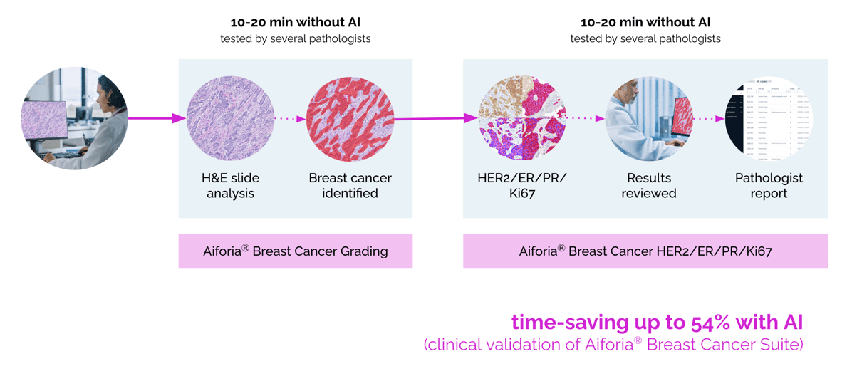 Breast cancer workflow 1