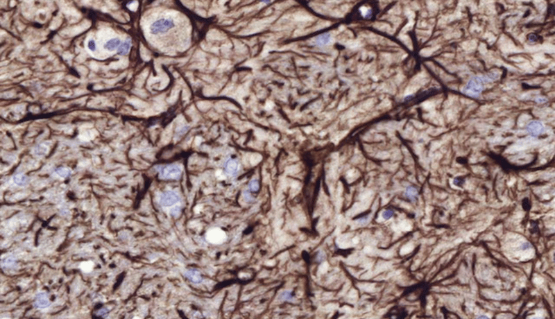 Orion pharma case study_ accelerating preclinical neurotoxicity analysis with AI_image