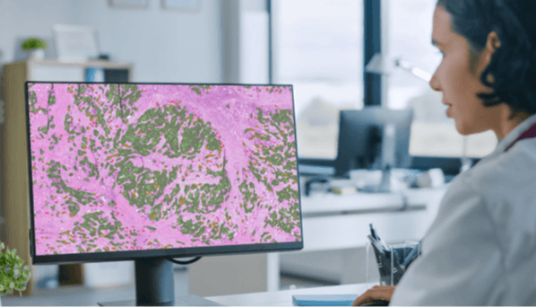 How did the Mayo Clinic choose a vendor for AI in pathology – carousel