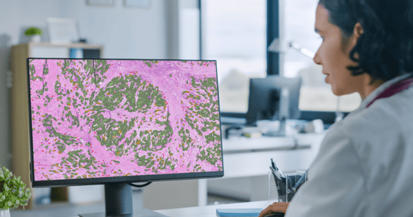 How did the Mayo Clinic choose a vendor for AI in pathology