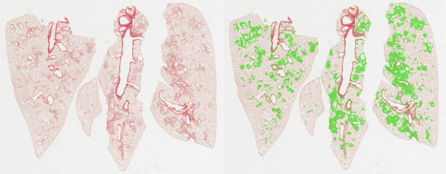 CRL case study: automated image analysis of lung fibrosis with AI