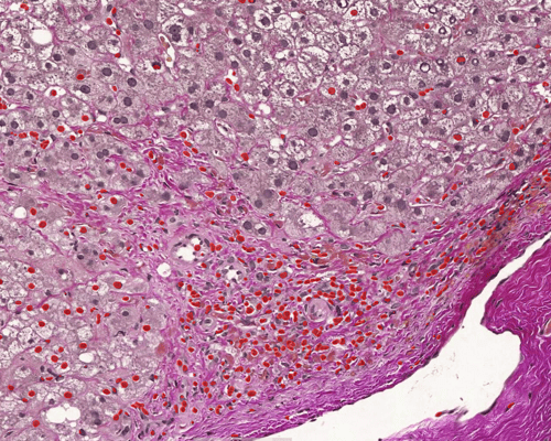 How does AI benefit toxicologic pathology?