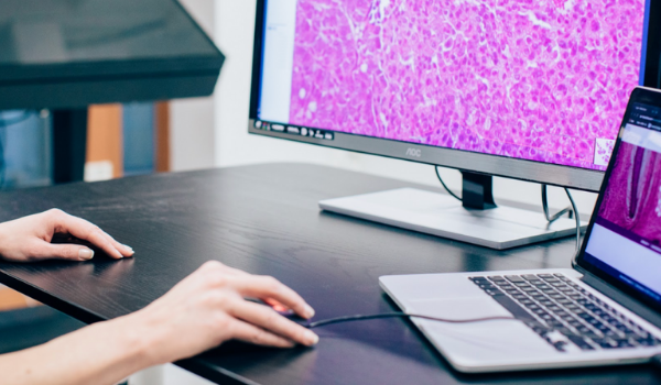 Case Skåne: one of the world’s largest digital transformations in pathology
