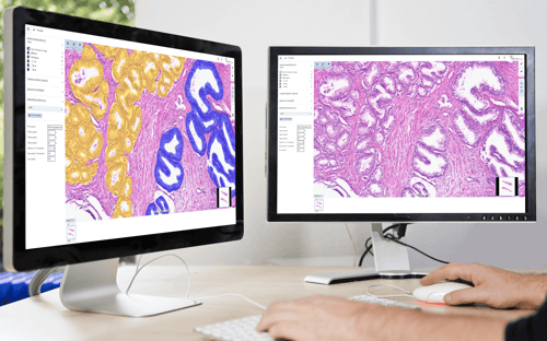 AP-HP has selected Aiforia as a partner for AI-assisted pathology image analysis