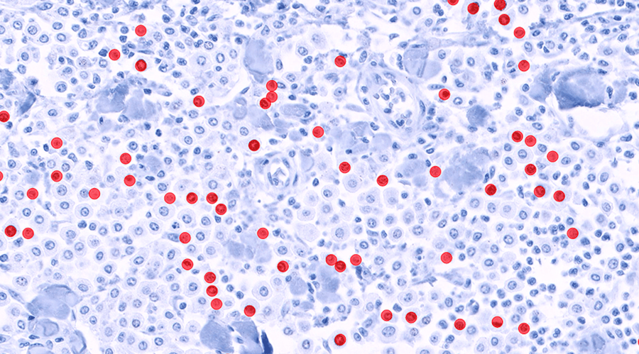 Finn Pathologists case study: Ki-67 scoring of canine mast cell tumors