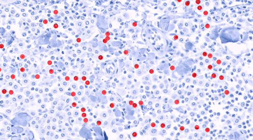 Finn Pathologists case study: Ki-67 scoring of canine mast cell tumors