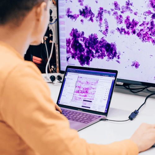 How to use artificial intelligence in pathology: introduction and benefits