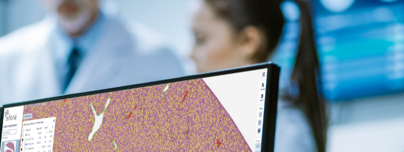 Using AI in anatomic pathology application to interstitial lung disease and liver transplantation-1