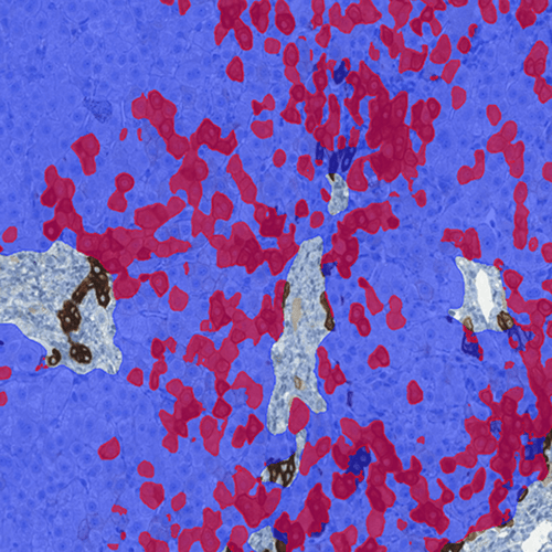 Digital Pathology: Artificial Intelligence Models in Gastrointestinal Diseases