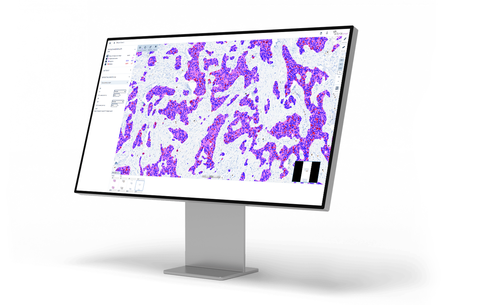 Ki67_monitor_right angle