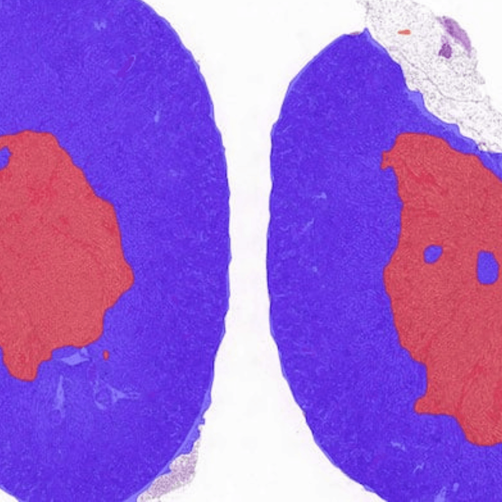 Developing an AI tool for renal pathology: case Galileo